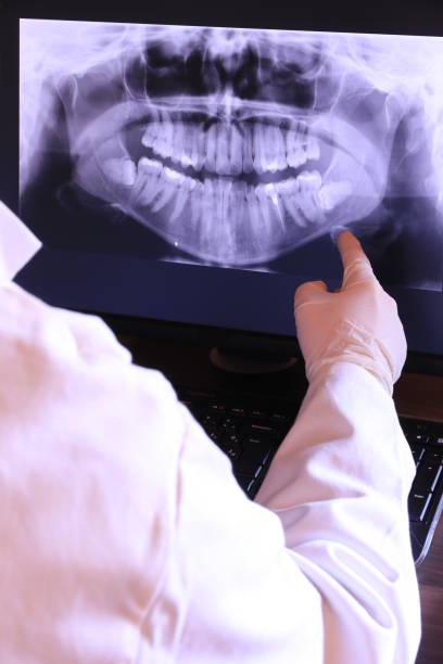 Best Emergency Dental Surgery in Forest View, IL