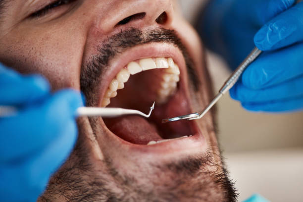 Best Emergency Root Canal Treatment in Forest View, IL